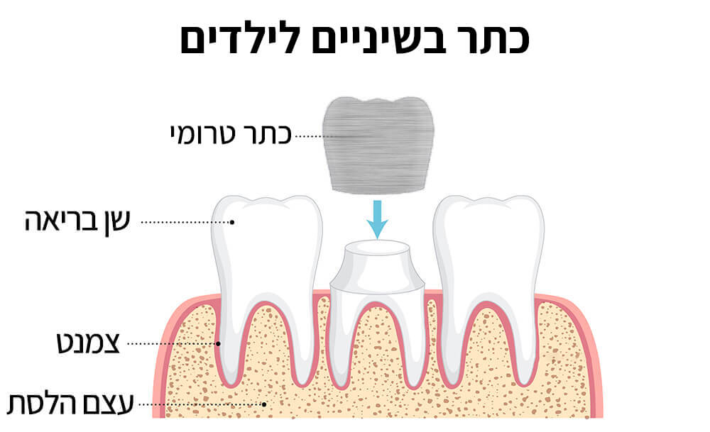 כתר טרומי לילדים